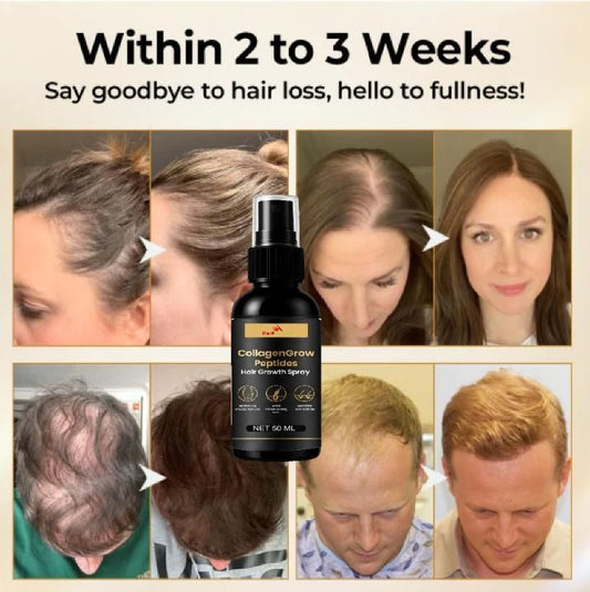 CollagenGrow Hair Growth Spray – Hair Fall Control & Thicker Hair Formula (50ml Pack of 2)